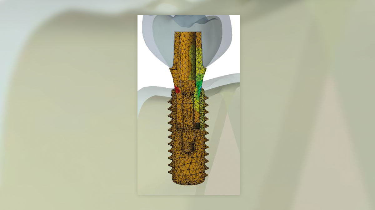 Darstellung eines Implantats